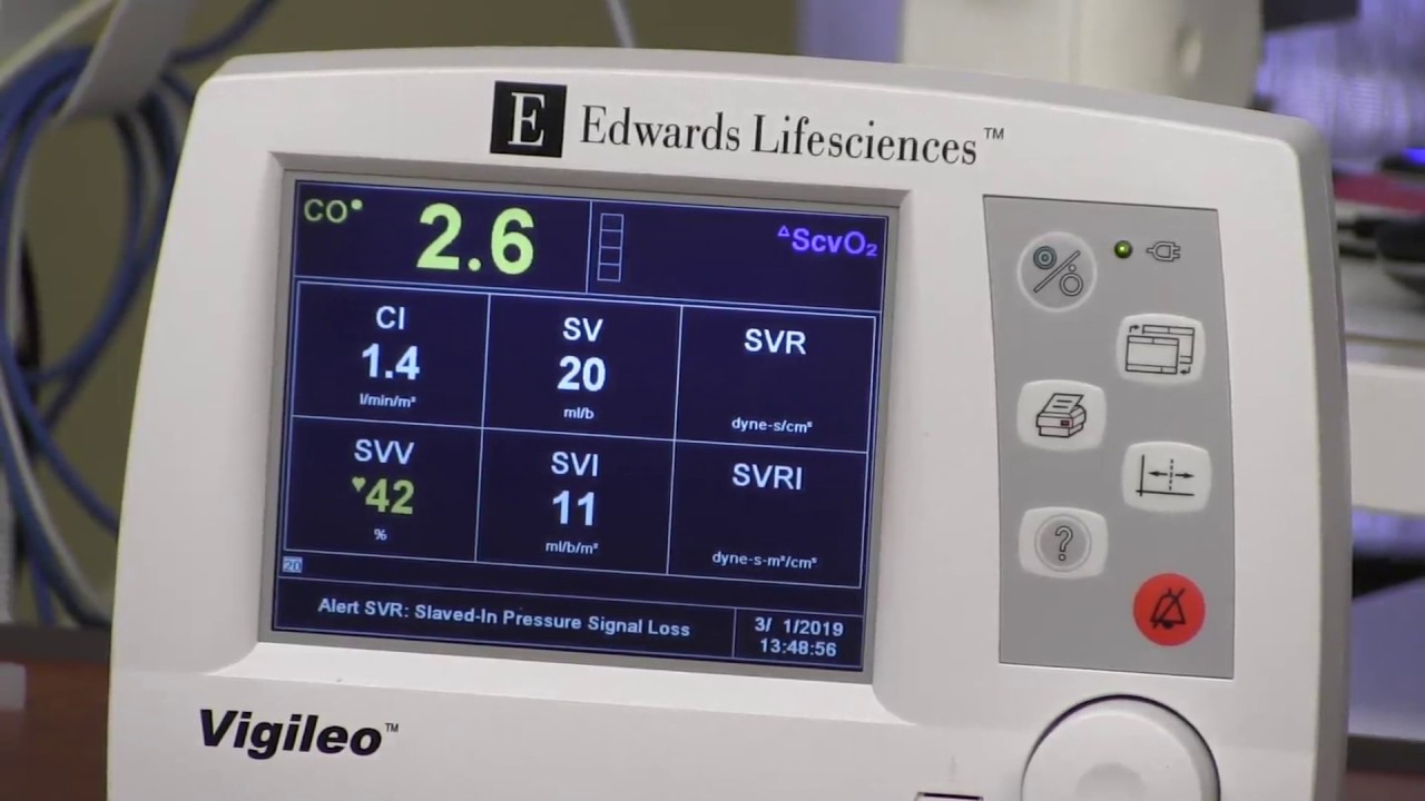 Vigileo & FloTrac Cardiac Output Monitor