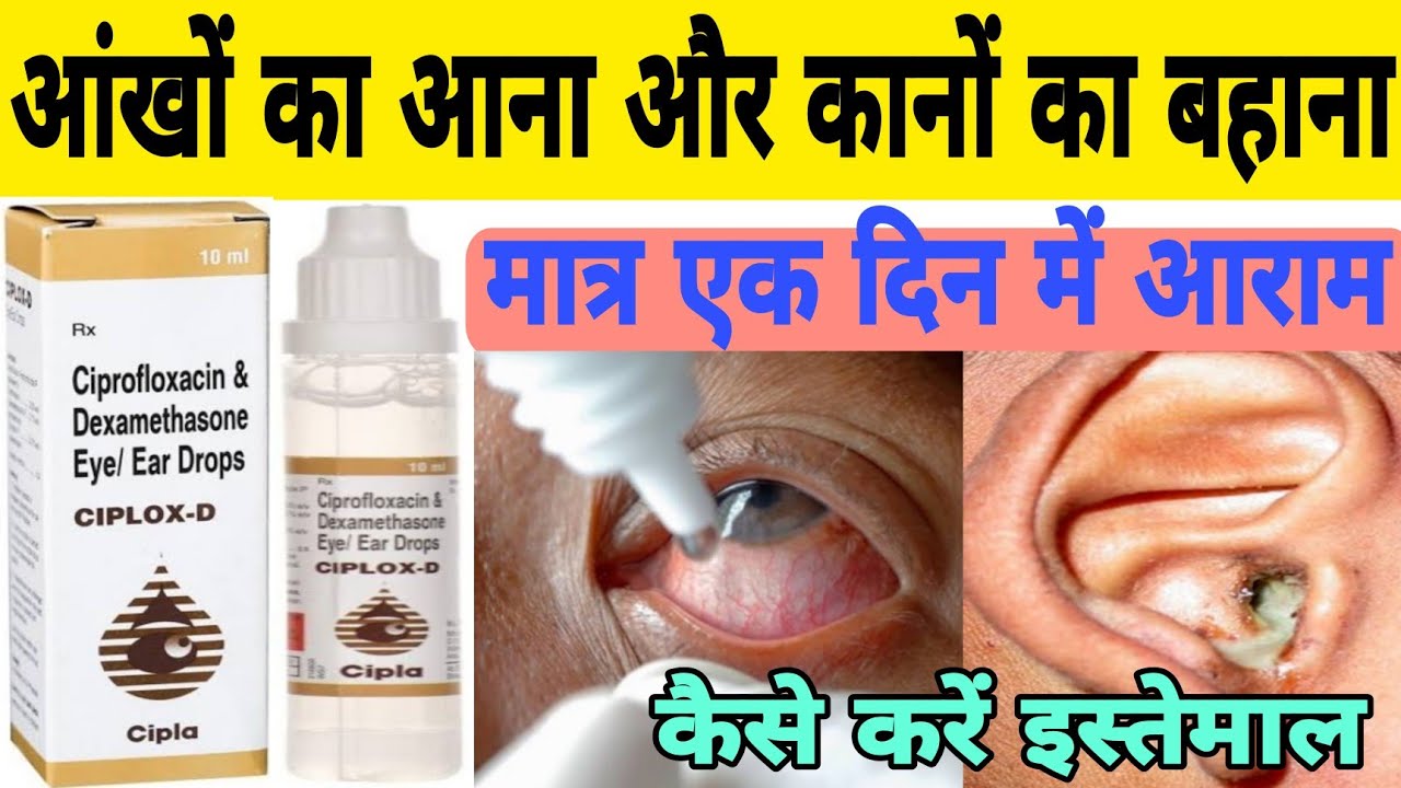 ciplox d eye ear drops review in hindi | ciprofloxacin dexamethasone eye ear drops how to use
