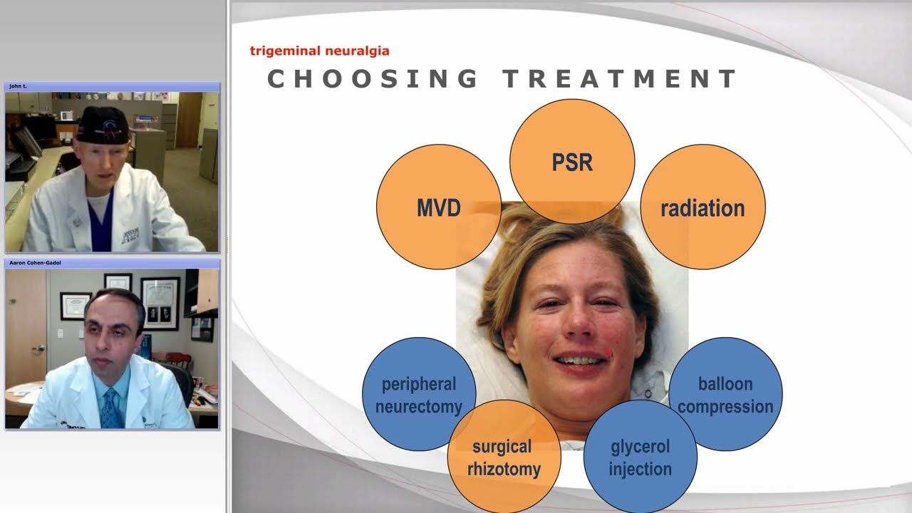 Percutaneous Procedures for Trigeminal Neuralgia: Radiofrequency and Balloon Compression (Preview)