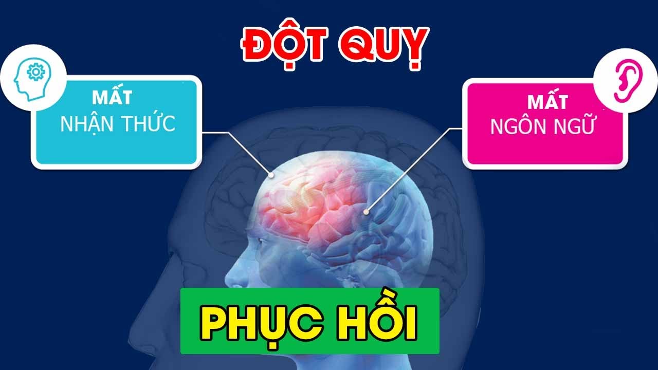 Tổn thương vùng ngôn ngữ sau đột quỵ: Cách khắc phục và phục hồi chức năng vùng ngôn ngữ