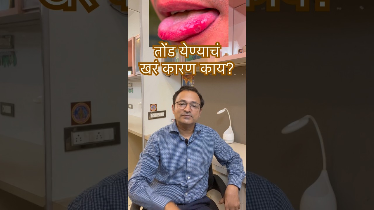तोंड का येते? कारणे व उपाय. Mouth ulcer#Ayurveda health tips