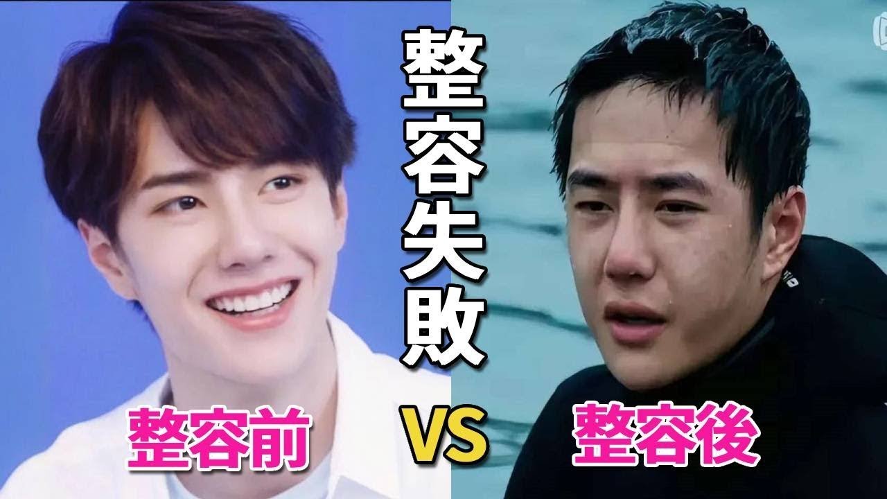 明星整容失敗有多慘？楊紫滿臉矽膠超僵硬，迪麗熱巴高清懟臉圖缺點全暴露，最後一個根本認不出！離開濾鏡醜根本沒法看#呱唧娛樂，楊冪，迪麗熱巴，趙麗穎，黃景瑜，楊紫，王一博，蔡徐坤，華晨宇