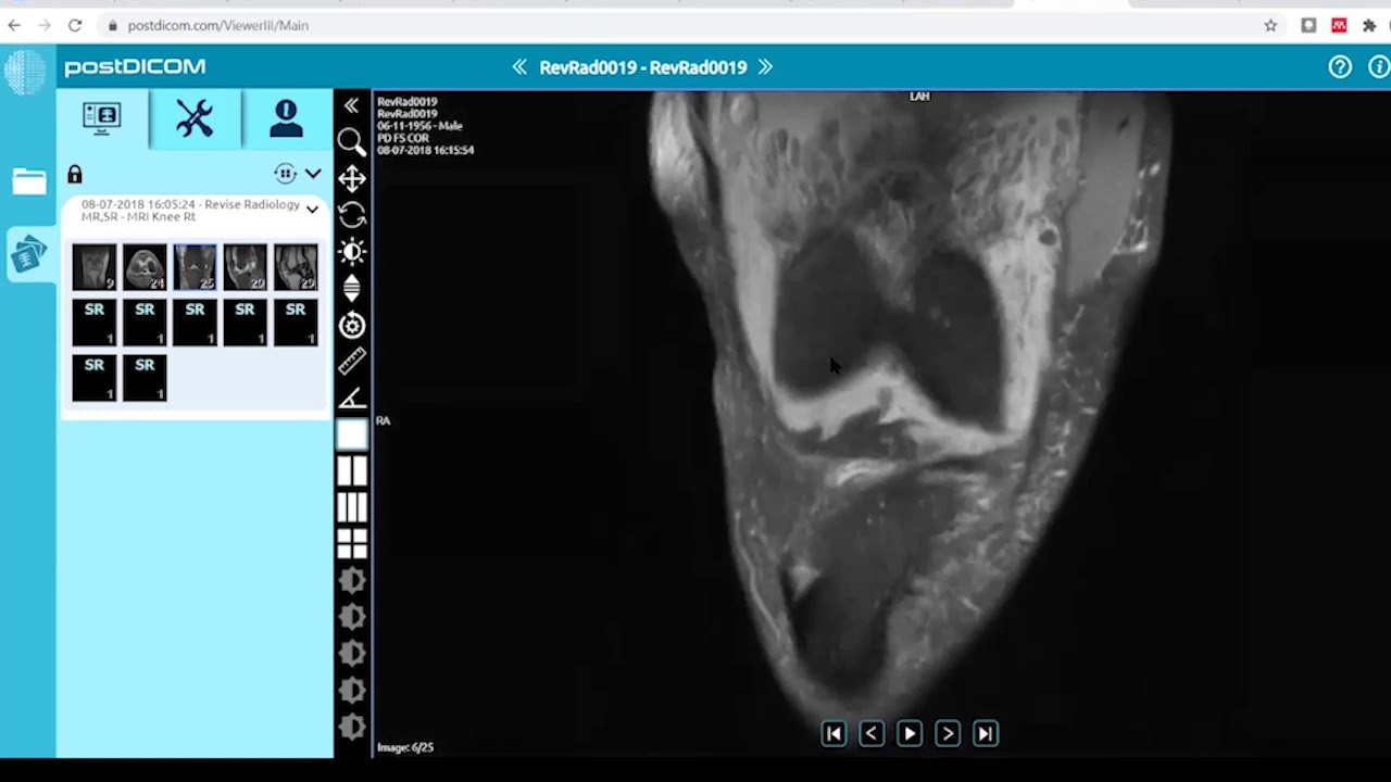 Online FRCR 2B Viva Practice || December 5 || Revise Radiology