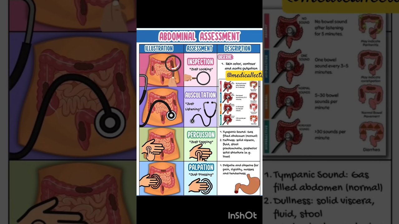 ABDOMINAL ASSESSMENT #shorts #viralvideo #medicallectures #neetpg #aiapget