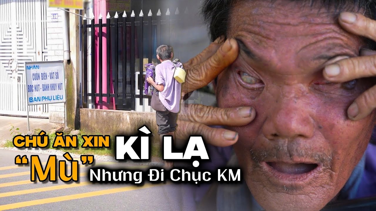 Kì Lạ Người Mù Tự Đi Hàng Chục KM Để Ăn Xin Sau Vụ N.ổ B.o.m