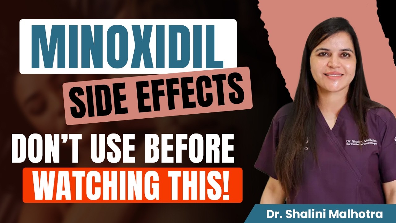 Minoxidil के Side Effects | Hair loss treatment in Hindi | Dr. Shalini Malhotra