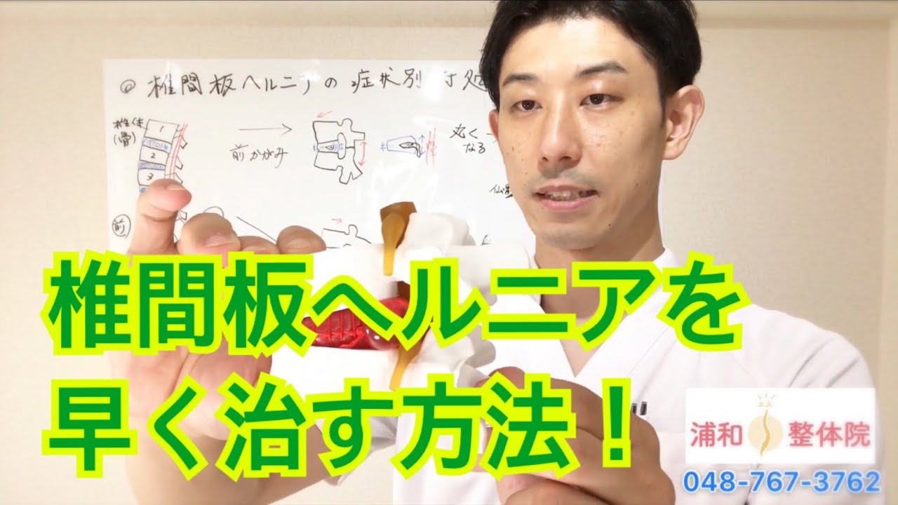 椎間板ヘルニアを早く治す方法　理論編　坐骨神経痛の方も必見！