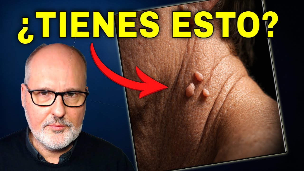 Estas Marcas en Tu Cuello Avisan de Algo Serio (y NO es la edad)