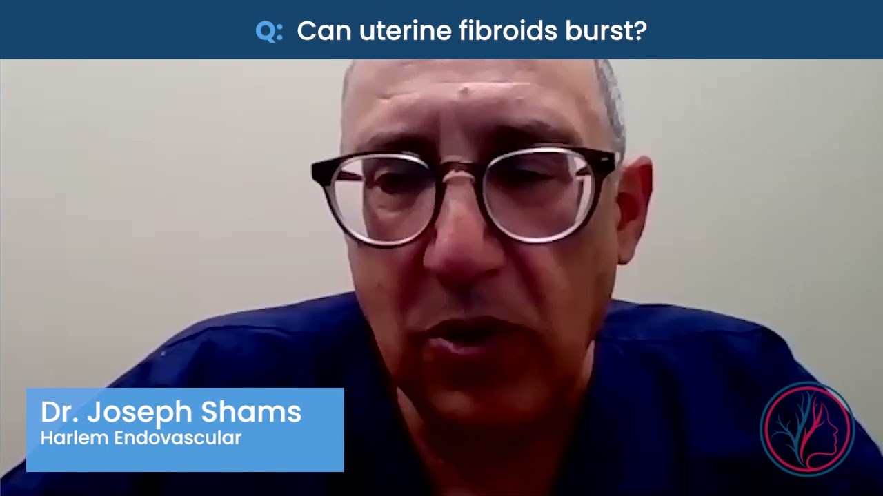 Can uterine fibroids burst?