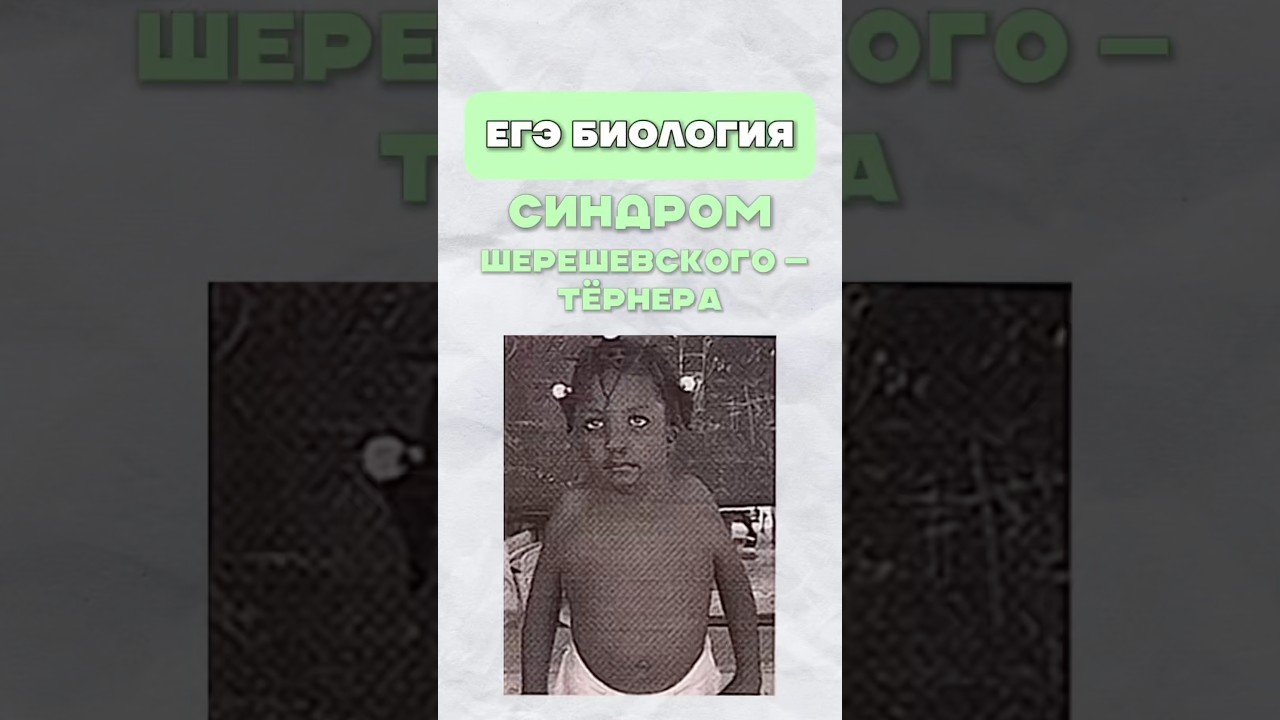 Синдром Шерешевского&mdash;Тернера #егэ #биология #синдром #заболевание #онлайншкола #жаннаказанская