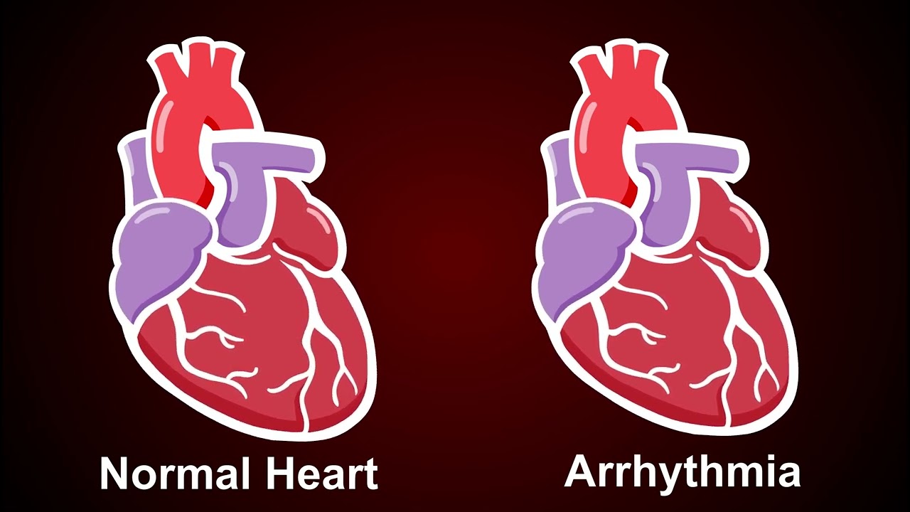 Abnormal Heart Rhythm & Heart Failure: Patient Guide