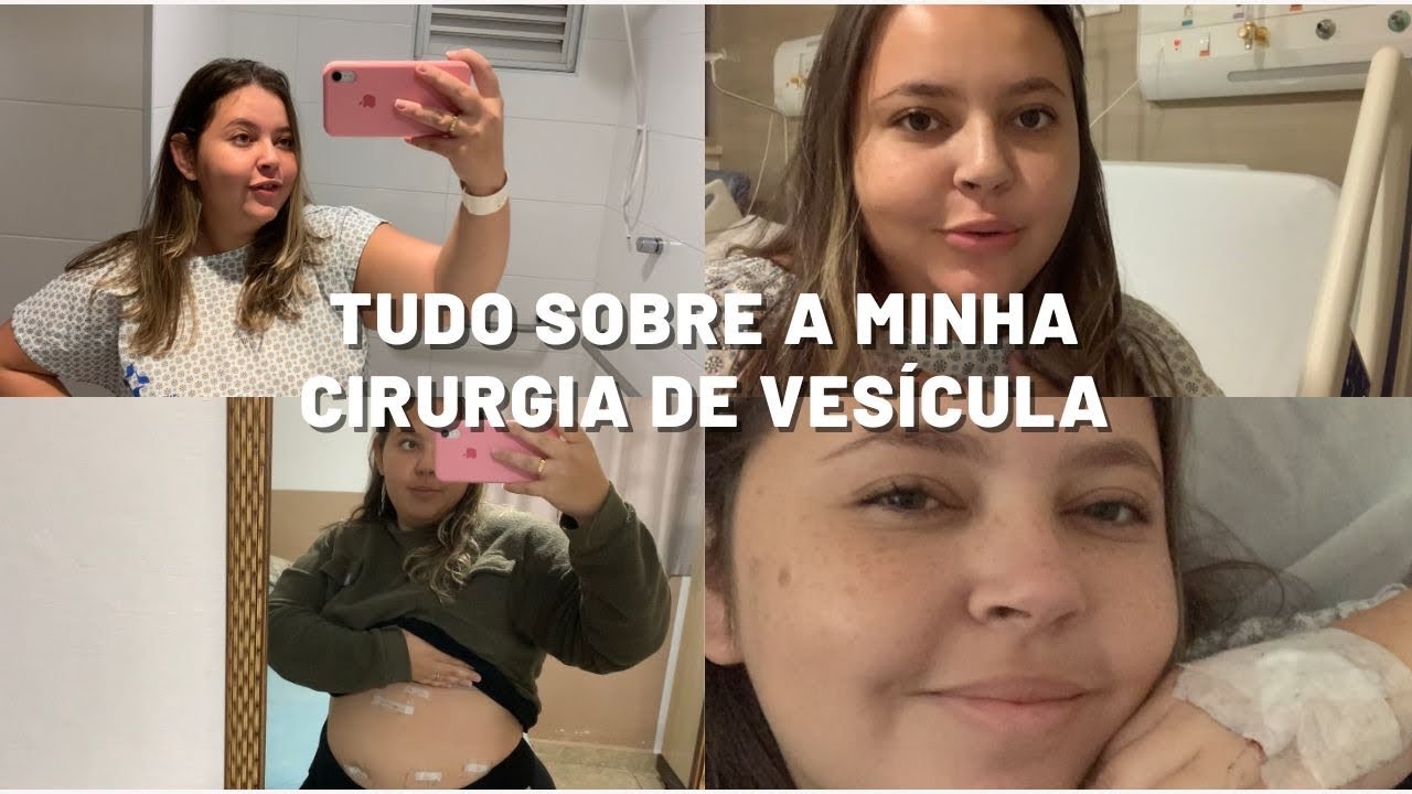 VLOG DA MINHA CIRURGIA DE VESÍCULA / FIZ COLECISTECTOMIA - Mostrei tudo