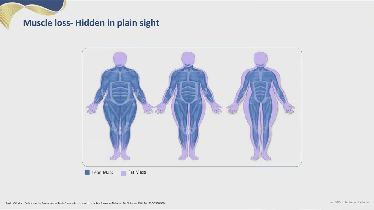 Dr  Ravindra Ghavat || The Myo-Metabolic Axis in CriticalCare: What Can We Do?