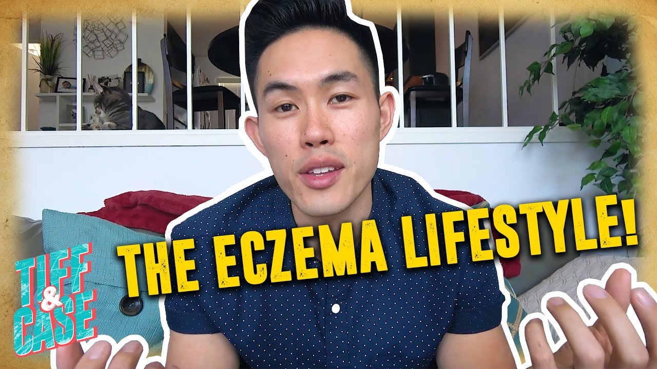 How I Live With ECZEMA