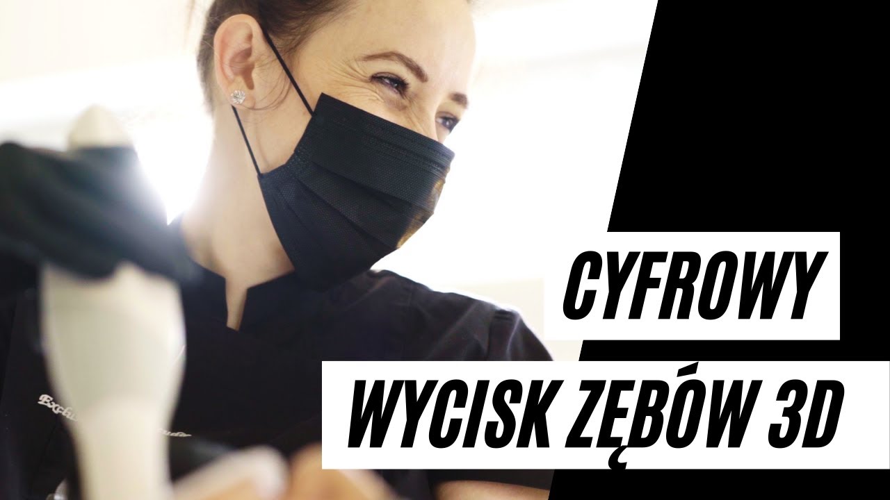 JAK POWSTAJE WYCISK CYFROWY ZĘBÓW? - SKANOWANIE WEWNĄTRZUSTNE 3D