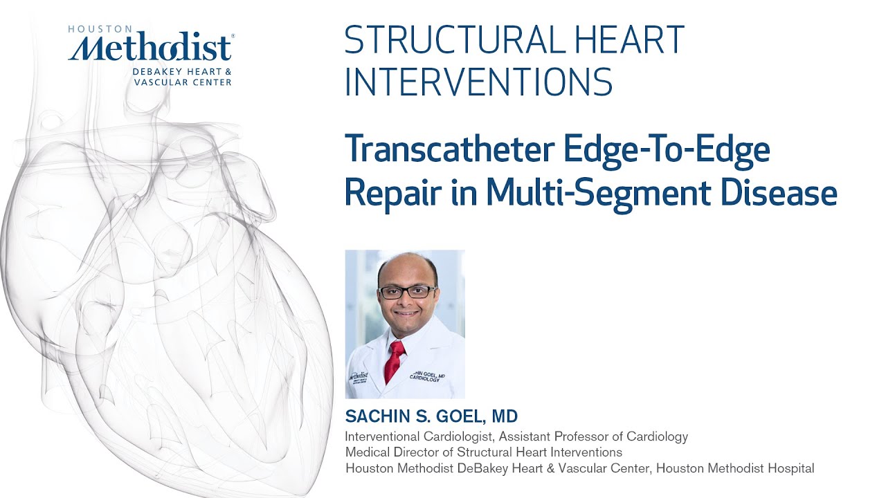 Structural Heart Intervention Series:  TEER in Multi-Segment Disease (Sachin Goel, MD)