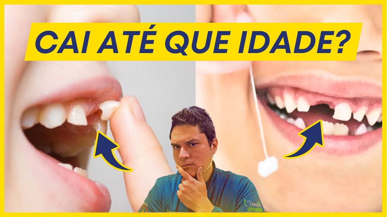 ATÉ QUANTOS ANOS O DENTE DE LEITE CAI?