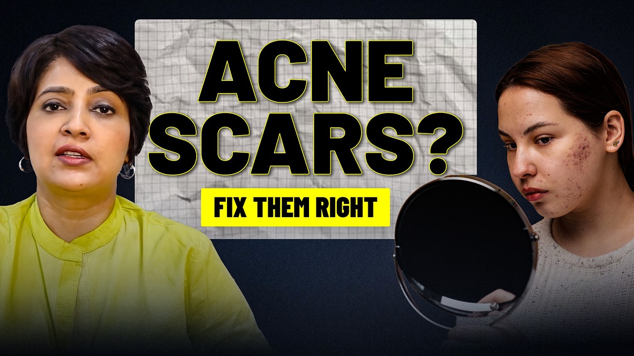 Acne Scars Treatment By Dermatologist | Best Skin Specialist In Bangalore | Dr. Rasya Dixit