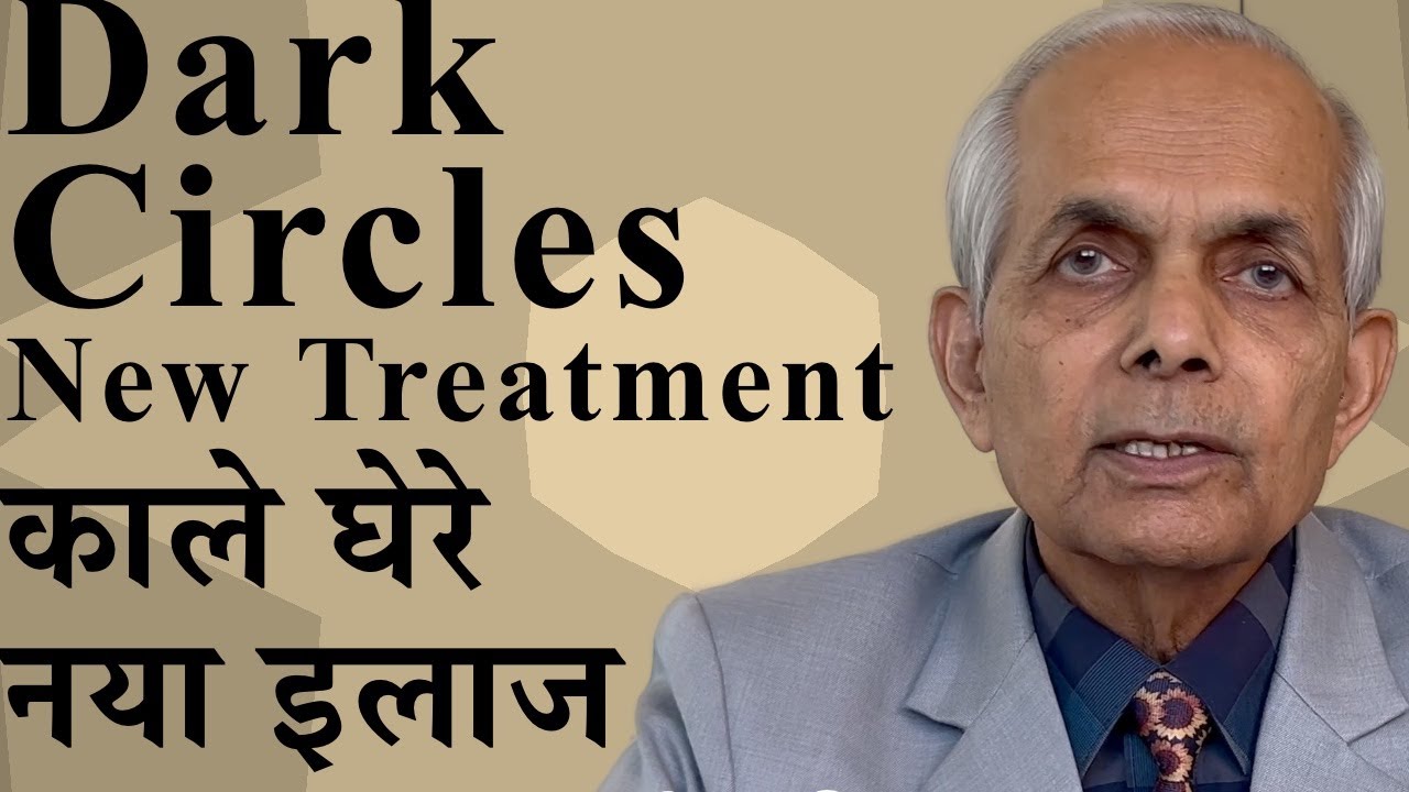 Dark circles New treatment/ काले घेरे का नया इलाज