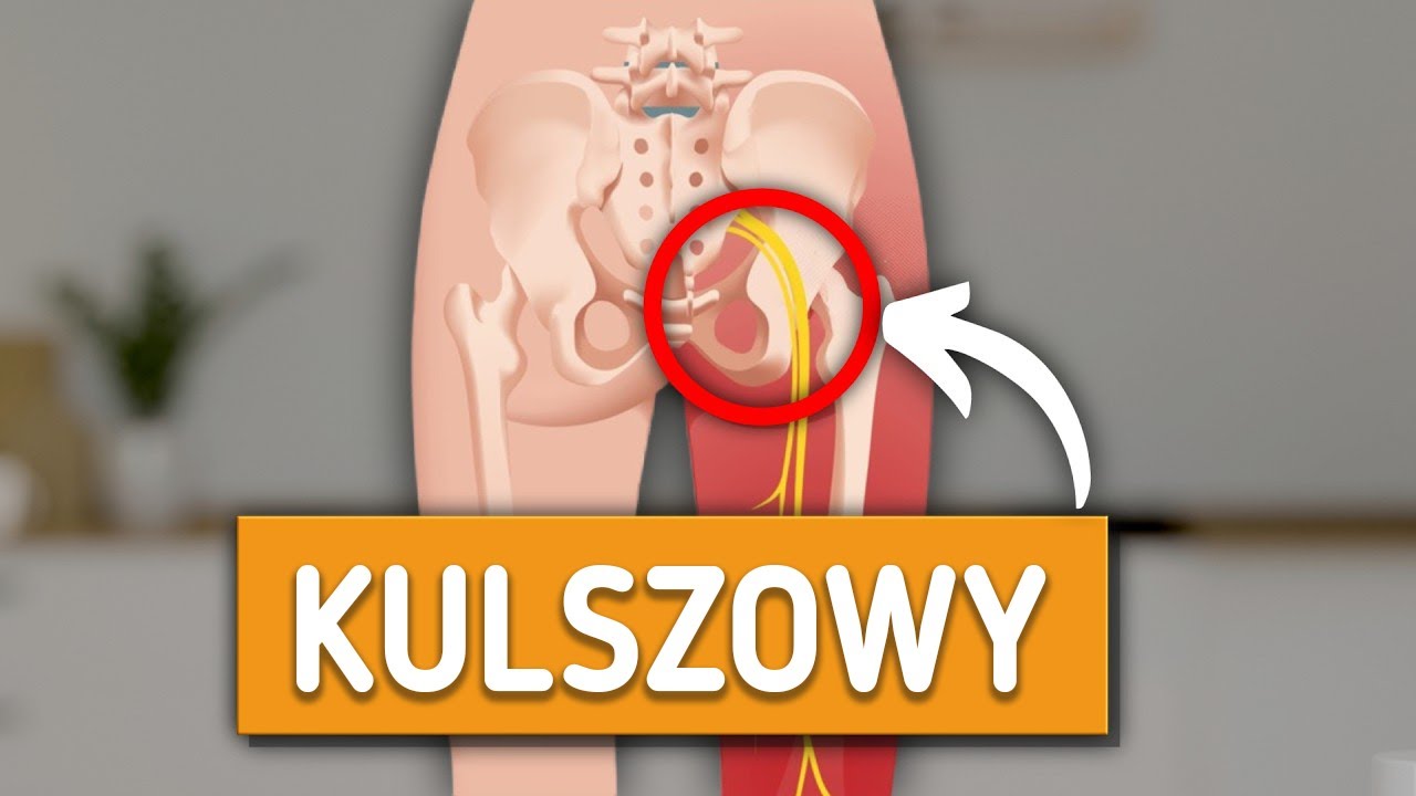 MOJE NAJWAŻNIEJSZE ćwiczenia na BÓL KULSZOWY (Ból biodra)