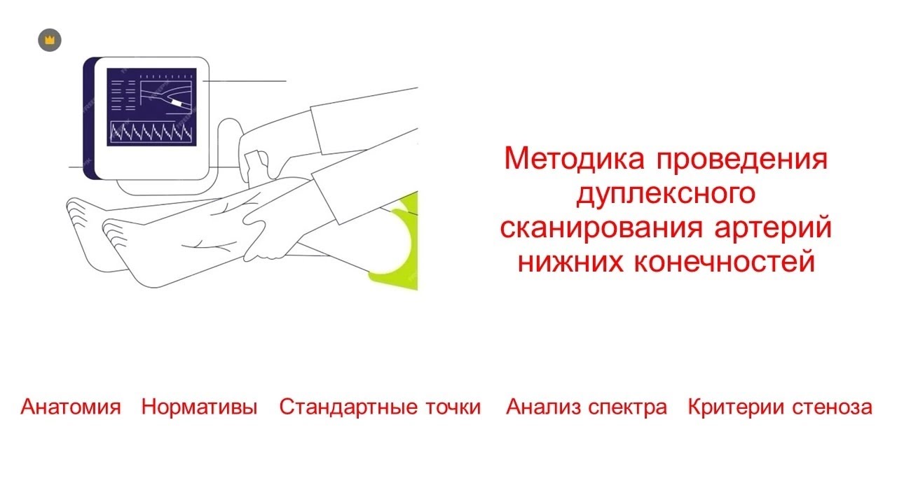 Методика УЗИ артерий нижних конечностей