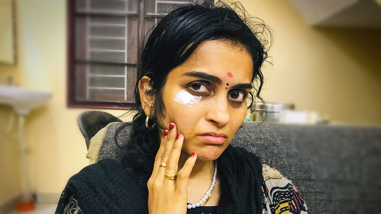 Small Pain Big Tension 😢 Under Eye Procedure