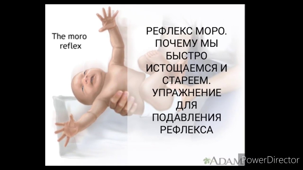 Рефлекс Моро.  Причина гнева, истощения и старости. Упражнение для подавления рефлекса