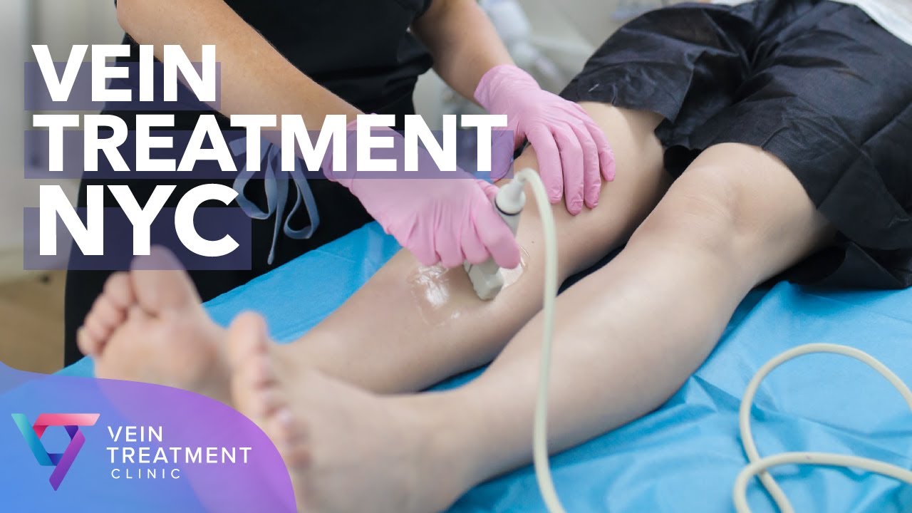 Medical Center: Vein Treatment NYC | Spider and Varicose Vein Treatment Center