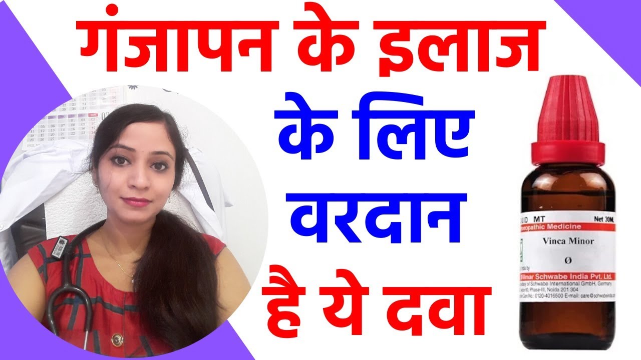 गंजापन का इलाज | गंजेपन को दूर करने के उपाय | गंजापन ख़त्म करने का तरीका| alopecia areata homeopathic