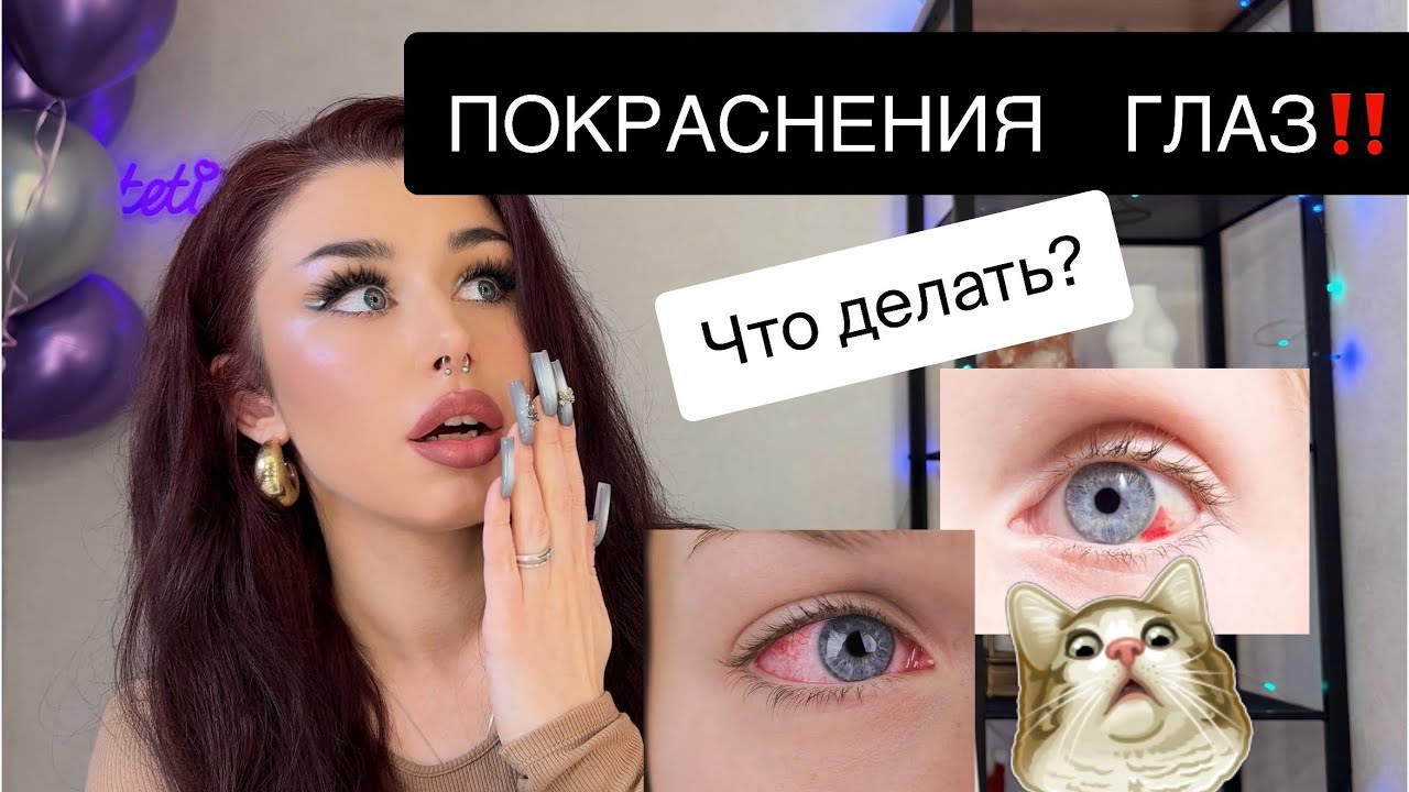 У КЛИЕНТКИ ПОКРАСНЕЛИ ГЛАЗА🤧разбираемся: как предотвратить и что делать