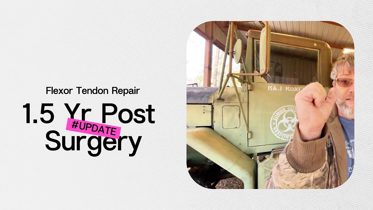1.5 Years Post Pinky Tendon Surgery – What Still Feels Different #handinjury #tendoninjury
