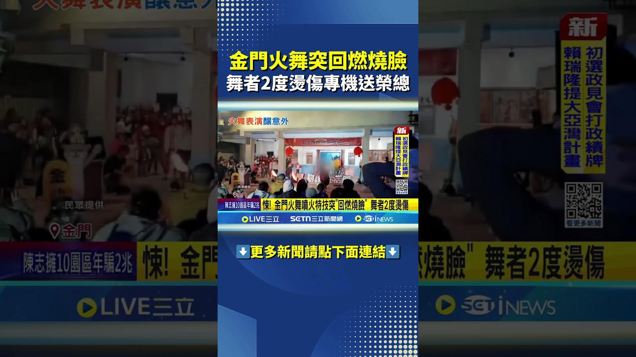 悚! 金門火舞噴火特技突"回燃燒臉" 舞者2度燙傷  