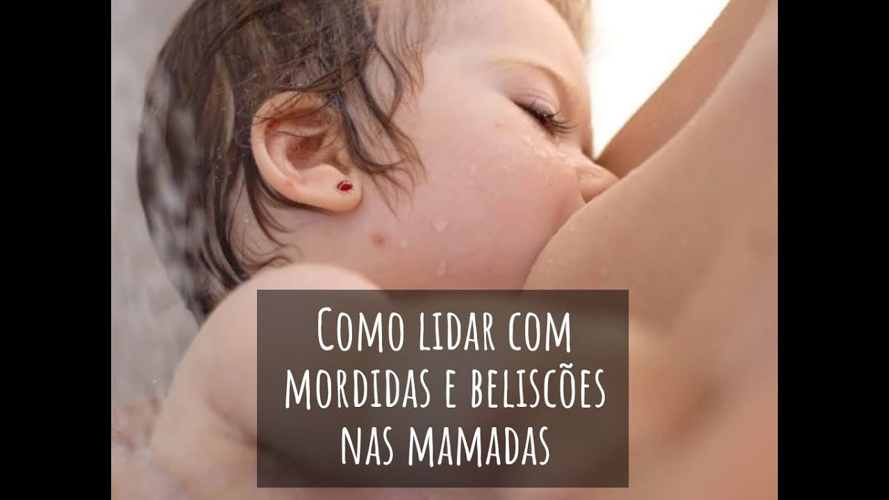 Como lidar com mordadidas e beliscões durante a amamentação