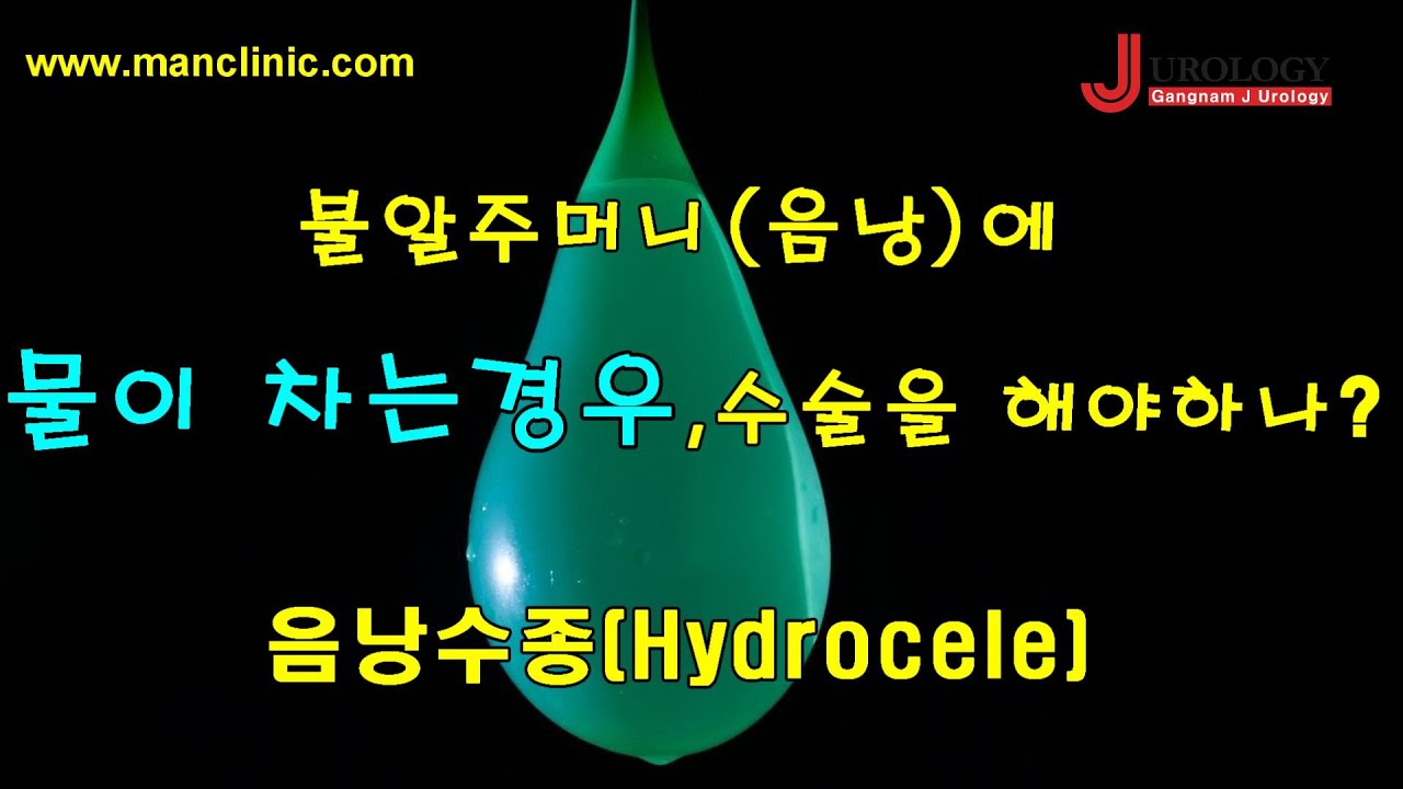 음낭에 물이 차는경우, 수술을 해야하나? 음낭수종 : Hydrocele - 비뇨기과 전문의 박천진의 읽어주는 컬럼 ⅩⅠ