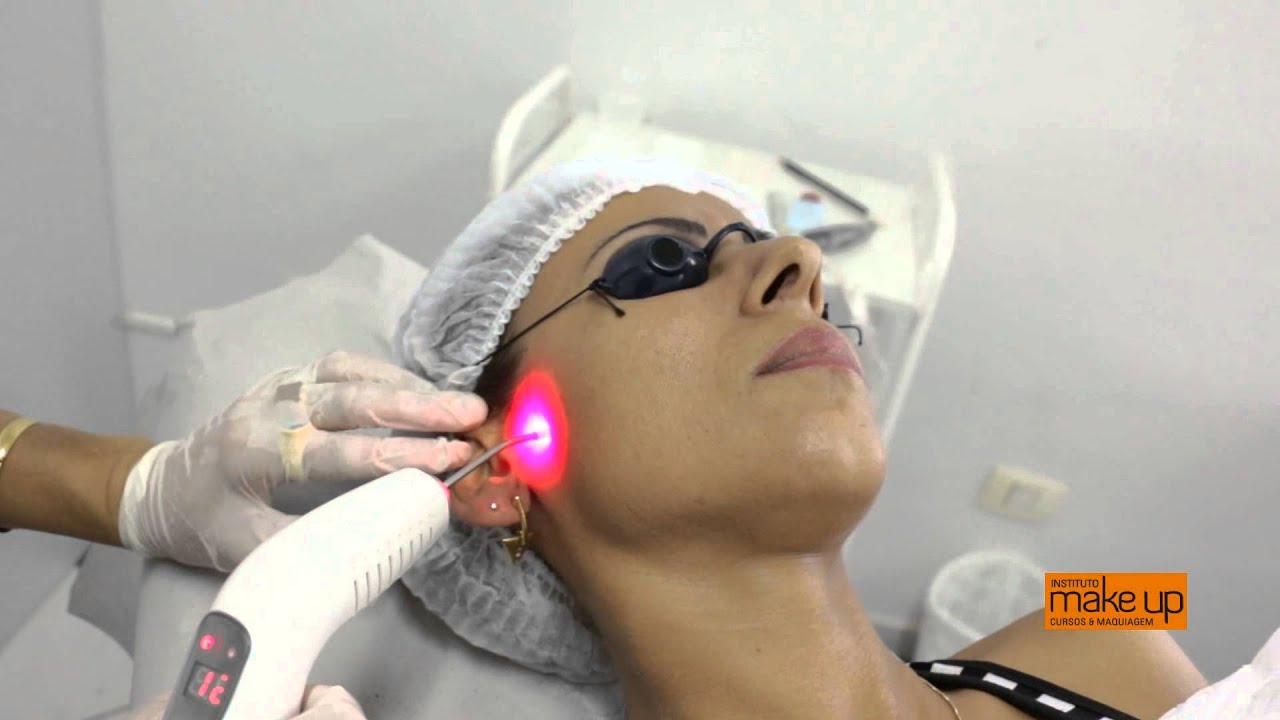 LASERTERAPIA NA MICROPIGMENTAÇÃO