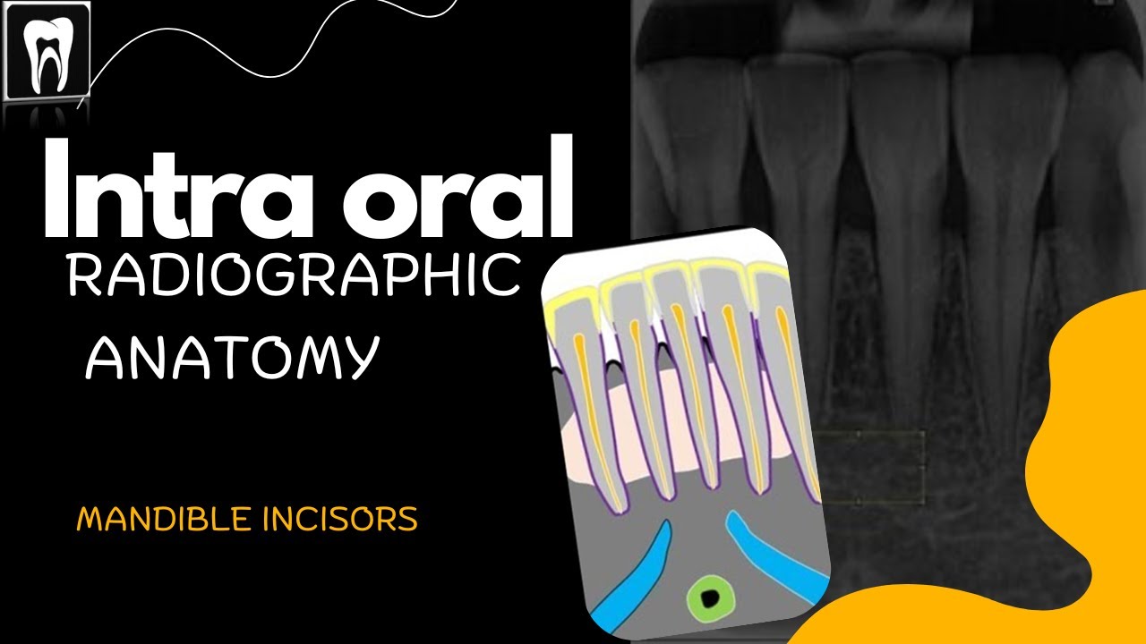 Normal radiographic anatomical landmark/ Intraoral Radiographic Anatomy of the mandible incisors