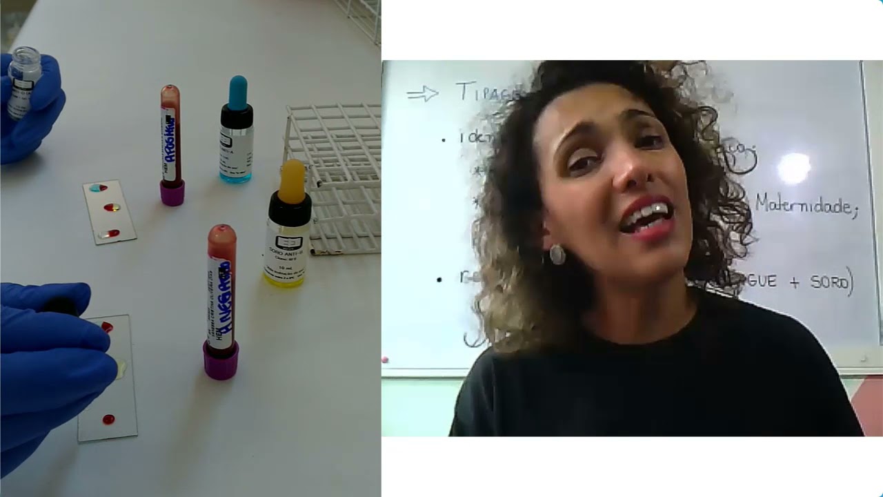 Aula Prática sobre TIPAGEM SANGUÍNEA