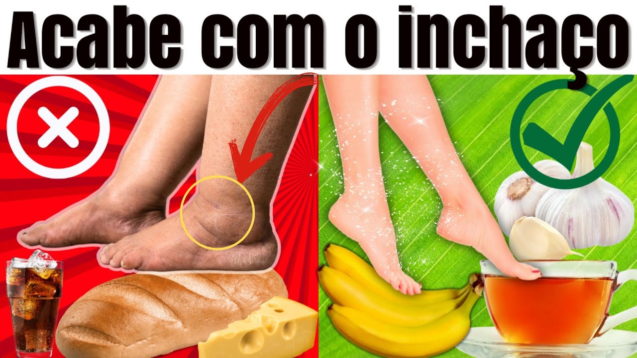 REMÉDIOS CASEIROS PARA EVITAR O INCHAÇO | TRATAMENTO NATURAL para DESINCHAR RÁPIDO os pés e pernas
