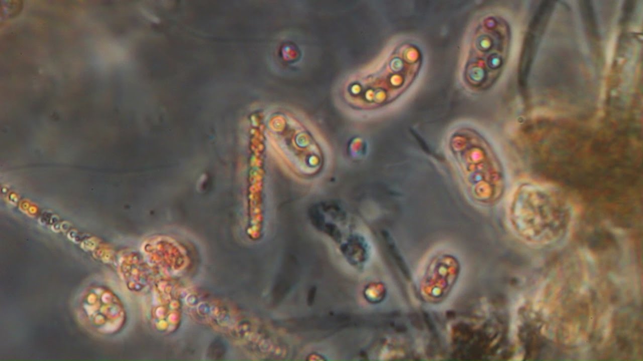 Sulfur oxydizing bacteria