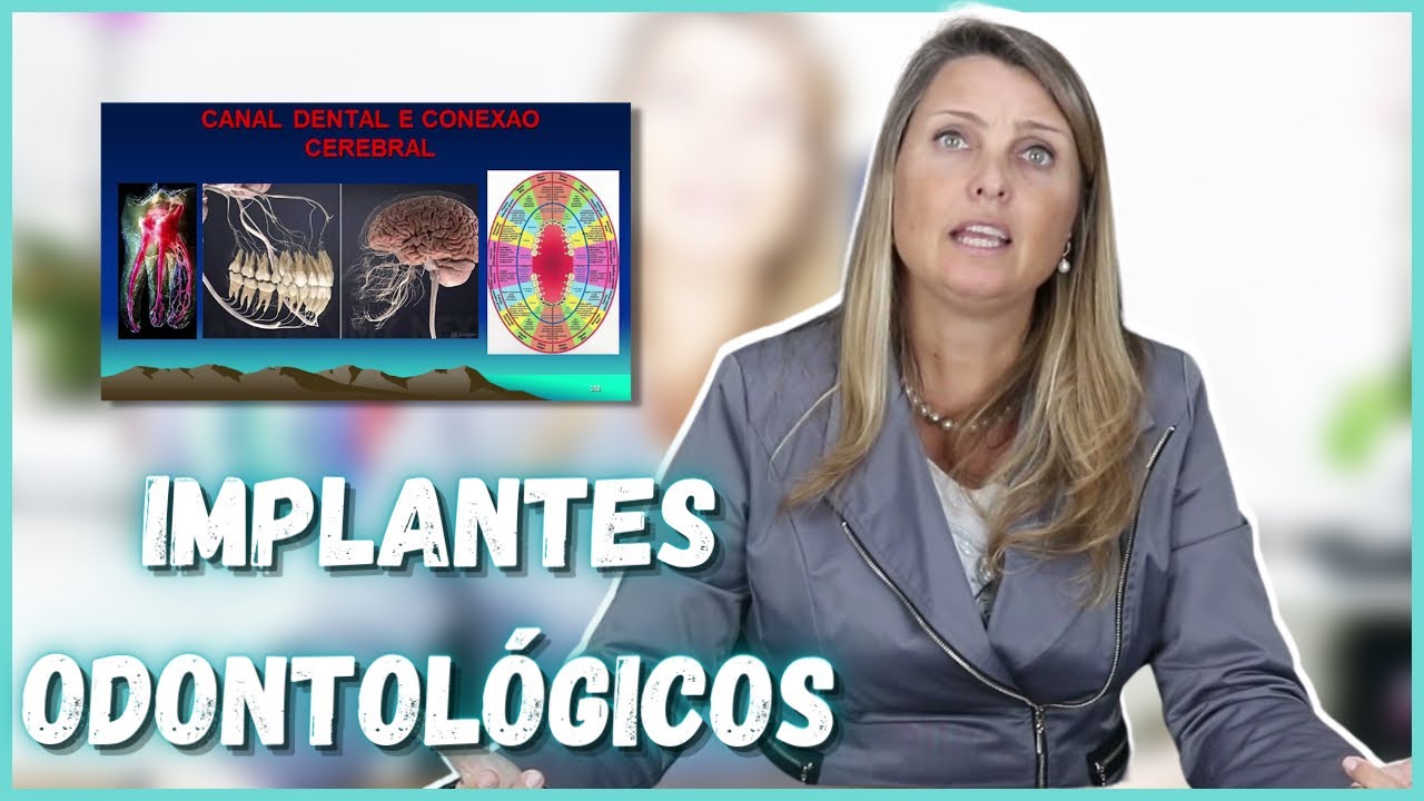 DICA DO DIA - IMPLANTES ODONTOLÓGICOS - @draelizetekaffer