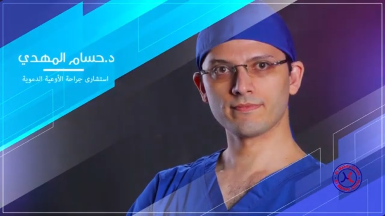 دكتور حسام المهدي يجيب علي اهم الاسئلة الخاصة بدوالي الساقين