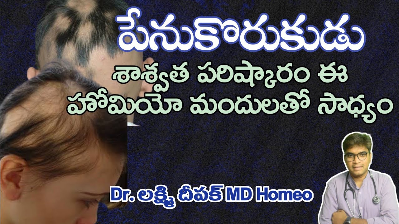 How To Cure Patchy Hair Loss Alopecia Areata Natural Treatment Dr Lakshmi Deepak MD Homeo