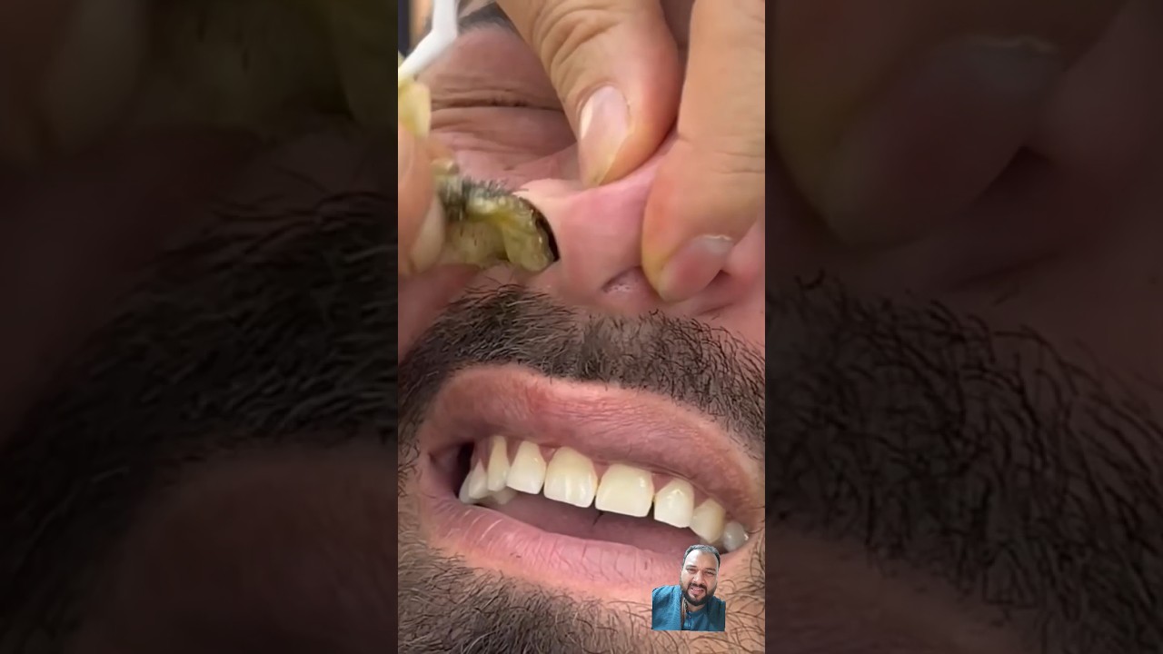 👃 nose waxing for man's reaction 😂 #nosewaxing#cutssaloon #mux9tvsalon #hairstyle