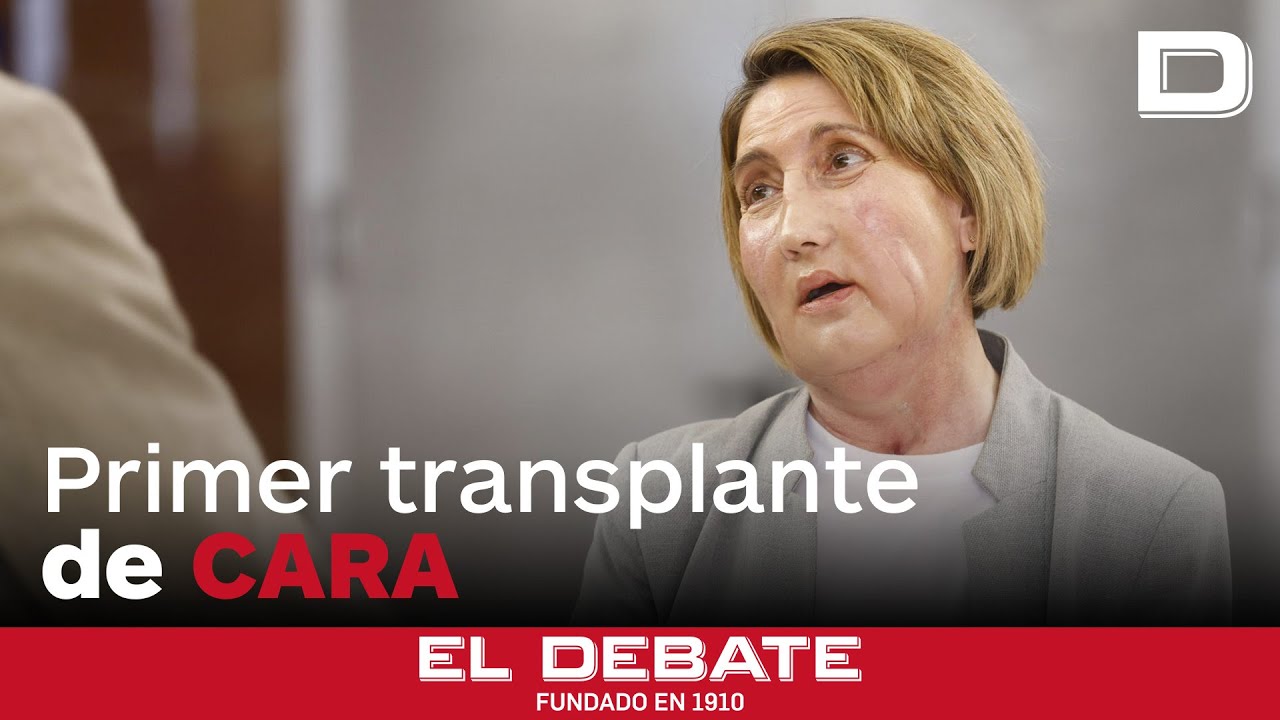 El hospital Vall d'Hebron completa el primer trasplante de cara del mundo