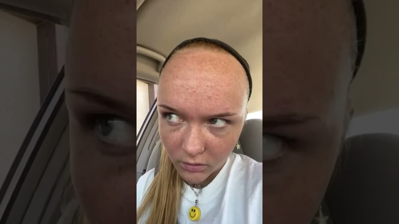 a maior testa do mundo 🤣#shorts