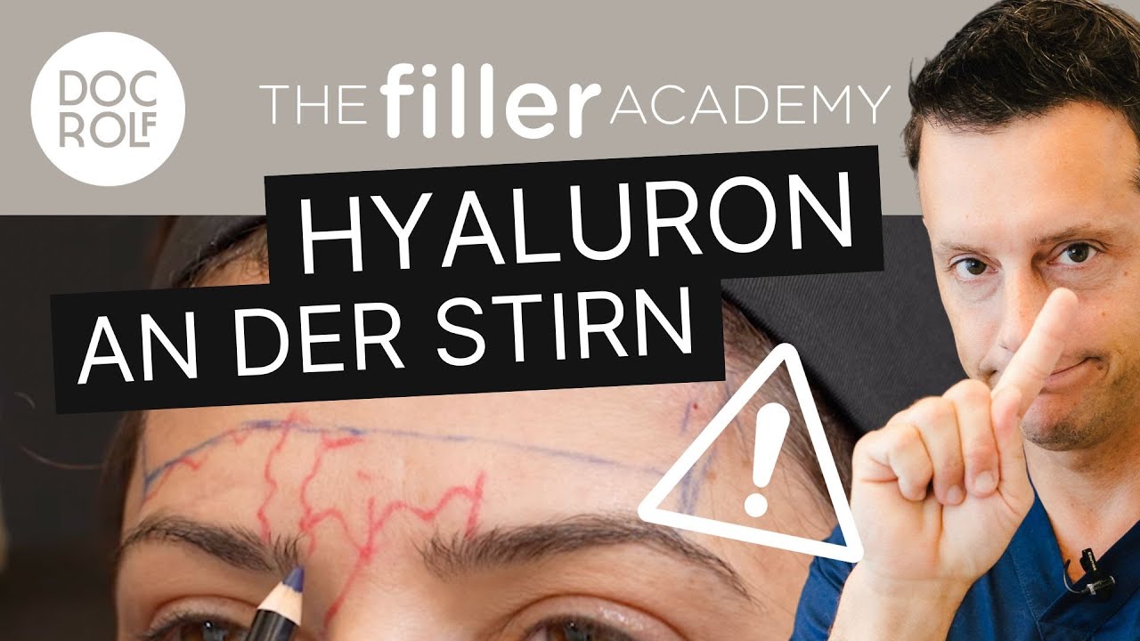 STIRN UNTERSPRITZEN MIT HYALURON FILLER– das musst du wissen! TFA by doc.rof