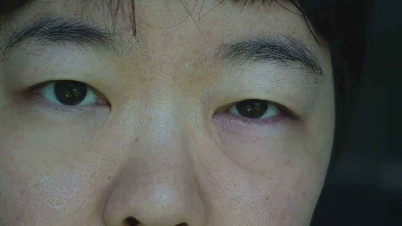 Understanding Eye Health Through Traditional Chinese Medicine |Eye Disorders 👁️ | Acupuncture & Herb