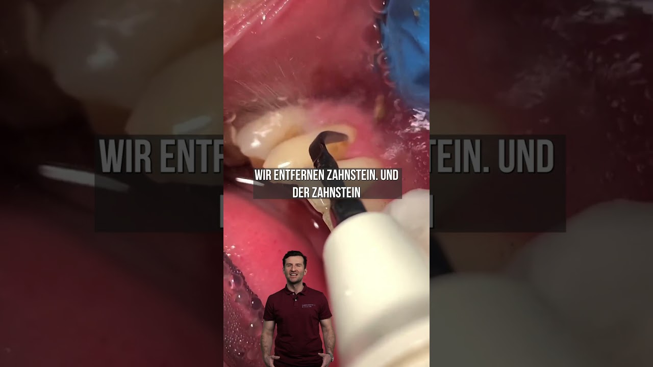 Darum sind regelm&auml;&szlig;ige Mundhygiene-Termine so wichtig #shorts