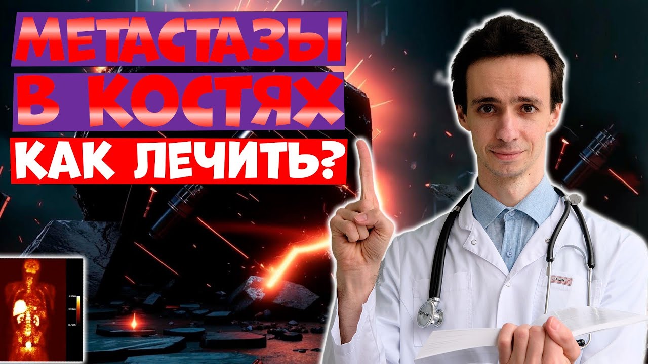 МЕТАСТАЗЫ в КОСТИ: как лечить? Современные методы в онкологии