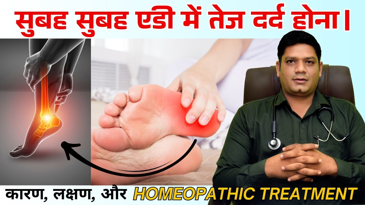 Heel Pain Homeopathic Treatment | Causes Symptoms & Homeopathic Medicine for #heelpain | Dr. Patidar